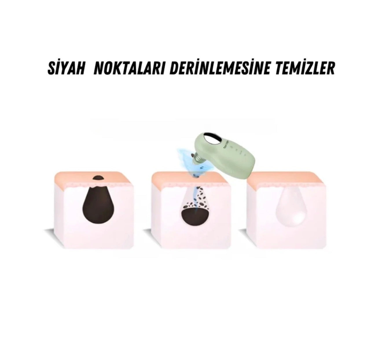 5 Başlıklı Şarjlı Siyah Nokta Temizleyici Vakum Cihazı | Gözenek Arındırıcı Cilt Bakım Aleti