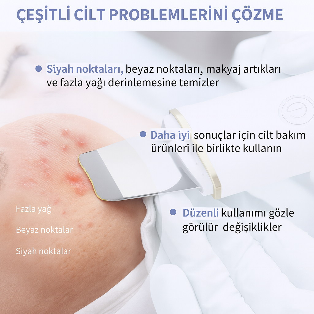 Şarjlı Ultrasonik Cilt Spatulası – Siyah Nokta & Akne Temizleyici